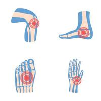 artritis íconos conjunto dibujos animados . humano articulación con dolor anillo vector