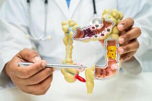 Intestine, appendix and digestive system, doctor holding anatomy model for study diagnosis and treatment in hospital. photo