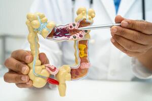 Intestine, appendix and digestive system, doctor holding anatomy model for study diagnosis and treatment in hospital. photo