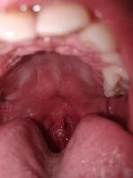 conditions in the mouth photo