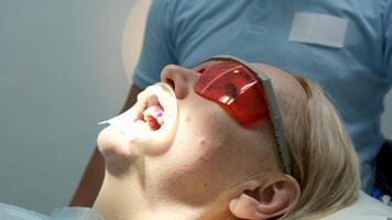 dentista homem extrair paciente dente dental clínica Extração procedimento mandíbulas chave inglesa. ultra Alto definição, ultrahd, video
