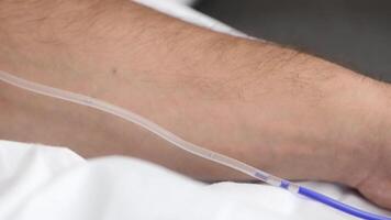 Plasmapheresis process, cleaning the patient's blood through the device. Action. Close up of male hand with blue liquid medication flowing inside dropper tube. video