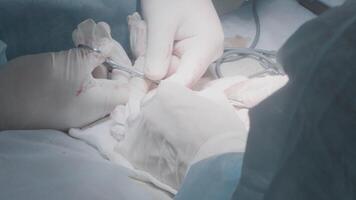 médicos executar Operação para retirar apêndice. Ação. cirurgiões operar em pessoa debaixo anestesia. tumor remoção e órgão cirurgia video