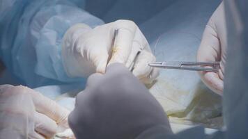 kirurger tillämpa stygn. handling. applicering kirurgisk suturer till patient under anestesi. kirurger professionellt och försiktigt tillämpa stygn efter allvarlig drift video