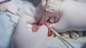 chirurgiens travail avec ouvert blessure et organe. action. chirurgiens Couper en dehors et Coudre en haut ouvert blessure dans organe. chirurgie sur ouvert interne organe. incision avec ouvert petit organe video