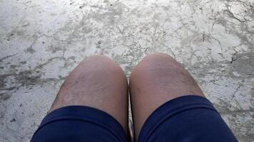 a person's legs with no hair on them photo