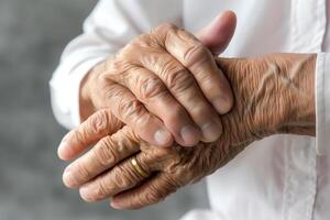 Hand of elder woman. Concept of rheumatoid arthritis, osteoarthritis, or joint pain. photo