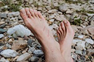 desnudo pies en contra el antecedentes de piedras, parte de el humano cuerpo piernas mentira en el banco de el río, rojo rayas desde el quemar en el pierna. foto