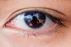 A close-up of a woman's eye with a man holding the camera within her eyelid. photo