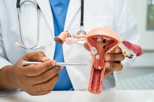 Uterus, doctor with anatomy model for study diagnosis and treatment in hospital. photo