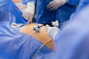 Instruments for gastroscopy and colonoscopy close-up. The doctor holds a flexible endoscope and biopsy forceps in his hands. Endoscopy and minimally invasive surgery photo