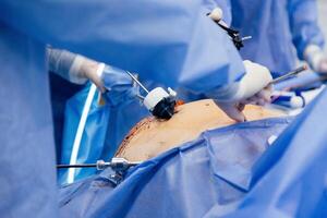 Instruments for gastroscopy and colonoscopy close-up. The doctor holds a flexible endoscope and biopsy forceps in his hands. Endoscopy and minimally invasive surgery photo