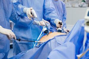 médico en azul estéril quirúrgico vestido haciendo cirugía con cámara y instrumento. ojo de cerradura cirugía estaba realizar en moderno operando habitación. avanzado laparoscopia foto