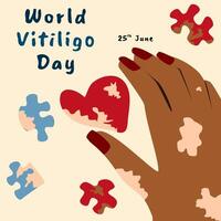 ilustración de mundo vitiligo día saludo con bronceado piel mano y rompecabezas piezas vector