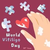 ilustración de mundo vitiligo día saludo con mano y rompecabezas piezas vector