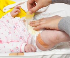 Leg of a newborn with the patch after vaccination. photo