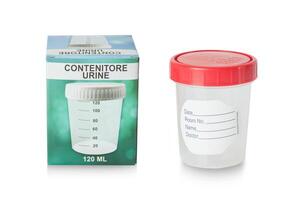 Urine sample in container photo