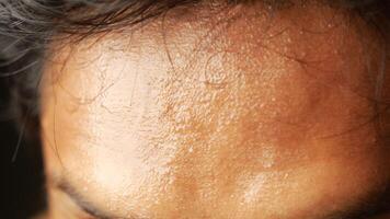 closeup of sweat on forehead against dark background , video