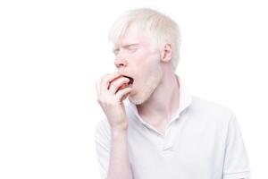 retrato de un albino hombre en estudio vestido camiseta aislado en un blanco antecedentes. anormal desviaciones raro apariencia foto