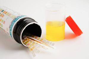 Urinalysis, urine cup for check health examination in laboratory. photo