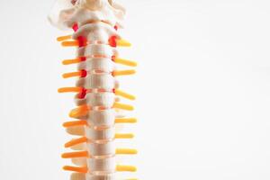 Spinal nerve and bone, Lumbar spine displaced herniated disc fragment, Model for treatment medical in the orthopedic department. photo