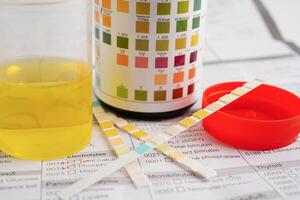 Urinalysis, urine cup with reagent strip pH paper test and comparison chart in laboratory. photo