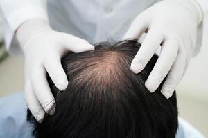 médico toque negrita cabeza en hombre, pelo pérdida tratamiento salud problema. foto