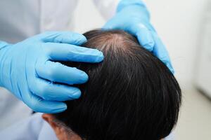 médico toque negrita cabeza en hombre, pelo pérdida tratamiento salud problema. foto