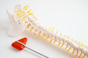 Spinal nerve and bone with knee reflex hammer, Lumbar spine displaced herniated disc fragment, Model for treatment medical in the orthopedic department. photo