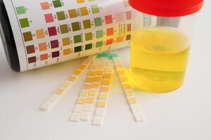 Urinalysis, urine cup with reagent strip pH paper test and comparison chart in laboratory. photo