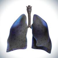 3D illustration of two lungs with cancer in the final stages where the lung tissue has turned black. vector