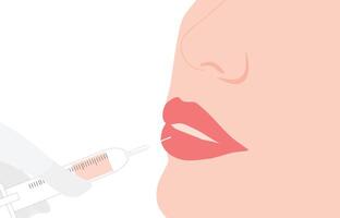 Filler injection concept. Serum syringe injects filler to lip of woman illustration. Plastic, aesthetic cosmetology beauty treatment concept vector