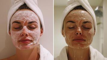 un antes de y después foto de un pacientes piel demostración el mejora en tez después regular sauna terapia.