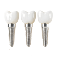 Three dental implant isolated on transparent background png