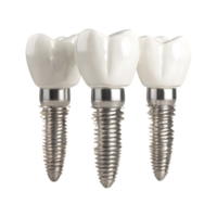 Three dental implant isolated on transparent background png