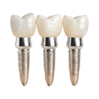 Three dental implant isolated on transparent background png