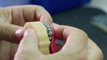 zirconio porcellana e impiantare studi nel il dentale laboratorio video