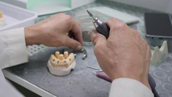 zirconium porcelaine et implant études dans le dentaire laboratoire video