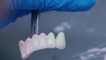 zirkonium porslin och implantera studier i de dental laboratorium video