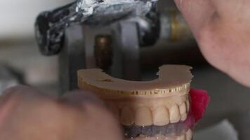 zirconio porcellana e impiantare studi nel il dentale laboratorio video