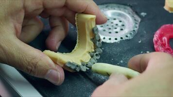 zirconio porcellana e impiantare studi nel il dentale laboratorio video