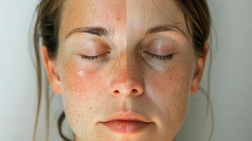 A before and after photo of a persons skin after a sauna session showing the effects of dehydration on skin health.