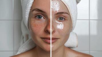 A splitscreen image showing before and after shots of a persons skin with the after photo depicting clearer and more balanced skin due to regular sauna use and its effect on hormones.