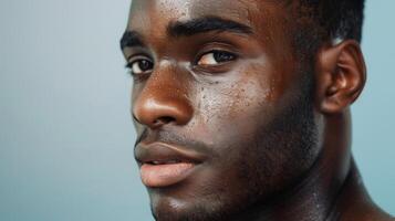 A man with flawless skin proudly displaying his unconventional birthmarks as a part of a beauty campaign aimed at promoting selflove and acceptance photo