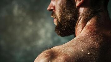 un foto de un mans hombro previamente marcado por enrojecimiento y irritación ahora visiblemente más tranquilo y mas suave debido a regular sauna usar.