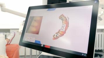 mirando a el pantalla y exploración el dental mandíbula en 3d espacio. moderno odontología. 3d exploración de dientes. video