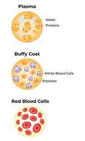 Plasma, Buffy Coat, Red Blood Cells Science Design Illustration Diagram vector