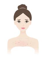 The woman with acne on chest illustration isolated on white background. Acne, pimples, blackheads, comedones, whiteheads, papule, pustule, nodule and cyst on body. Skin problem concept. vector