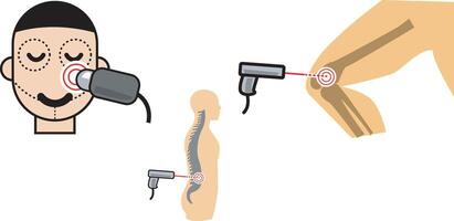 laser medical therapy vector
