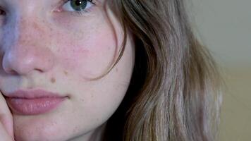 Gesicht von ein Teenager Mädchen mit Sommersprossen Nahansicht Jugend Haut Änderungen rot Flecken auf das Gesicht schön Mädchen geschwollen Augen Allergie Bulk Apfel groß runden Gesicht Licht bilden europäisch Kind video